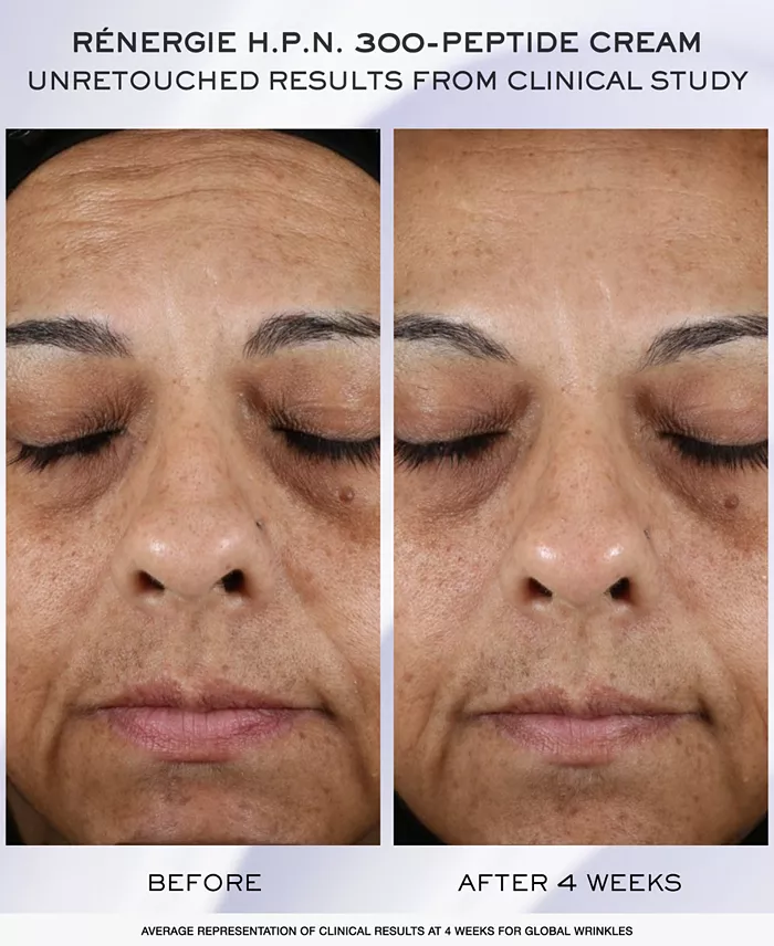 Lancôme 3-Pc. Rénergie H.C.F. Triple Serum Discovery Set Beauty