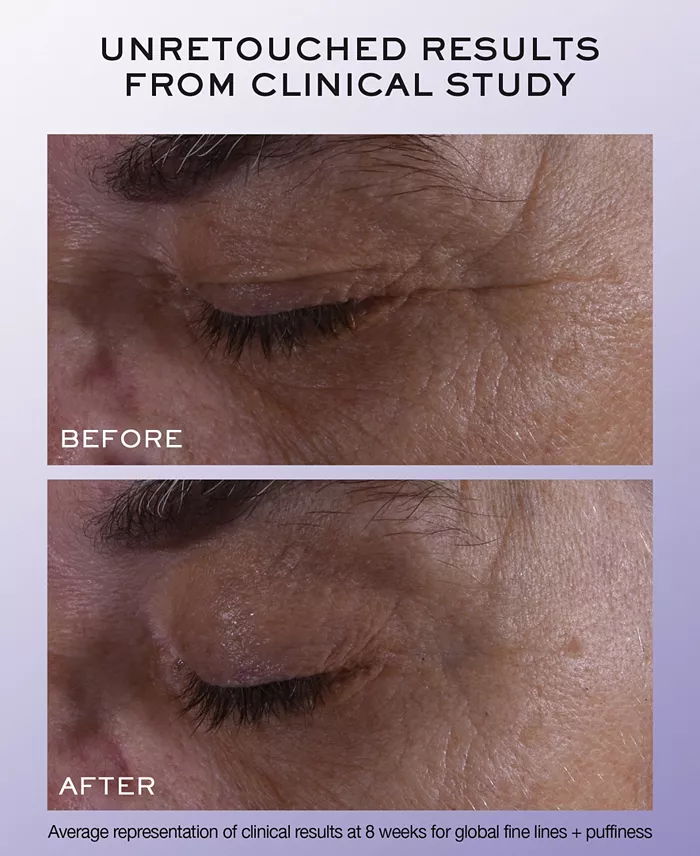 Lancôme Rénergie H.C.F. Triple Serum Eye 0.67 Oz. Beauty